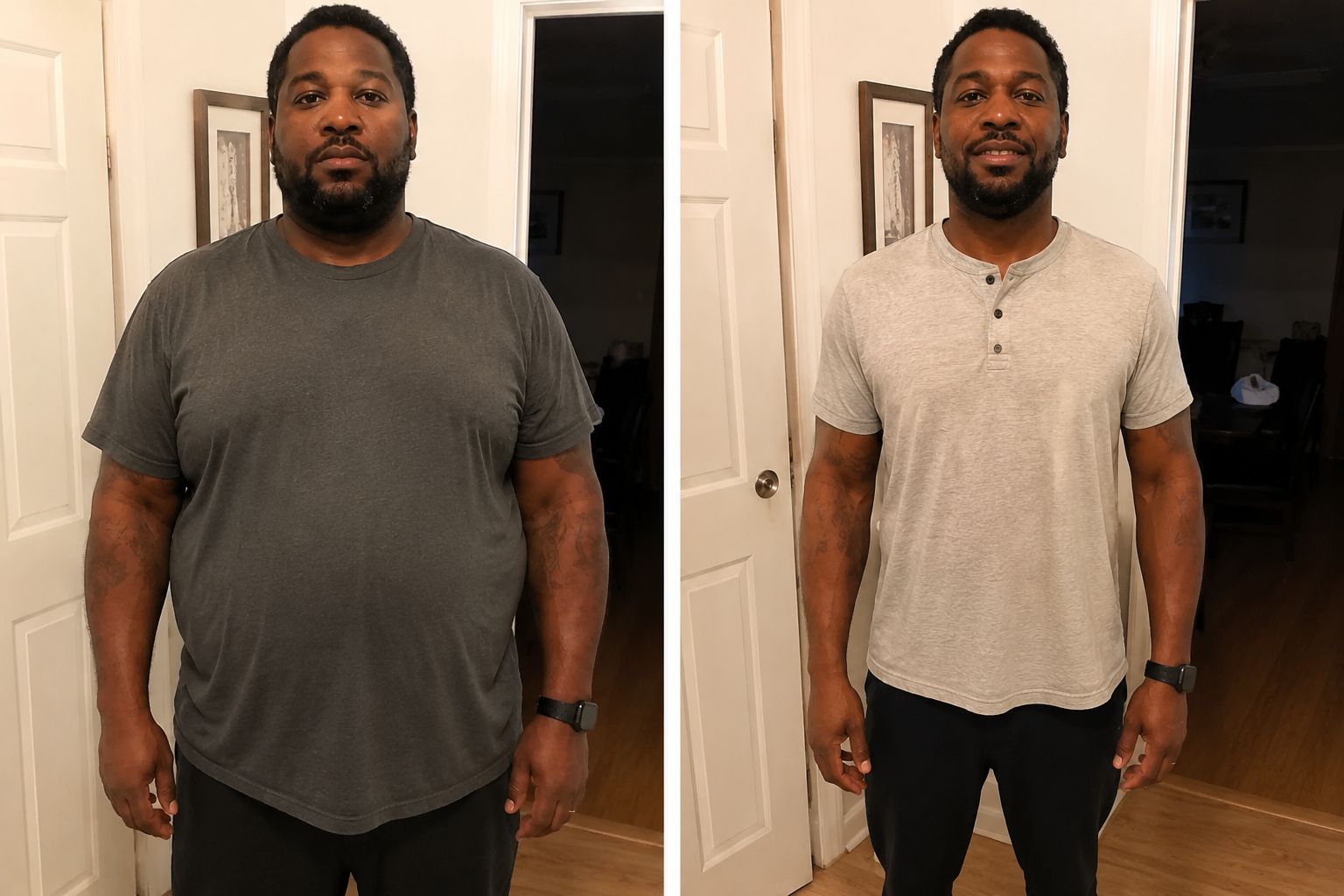 Before and after transformation image from a weight loss patient