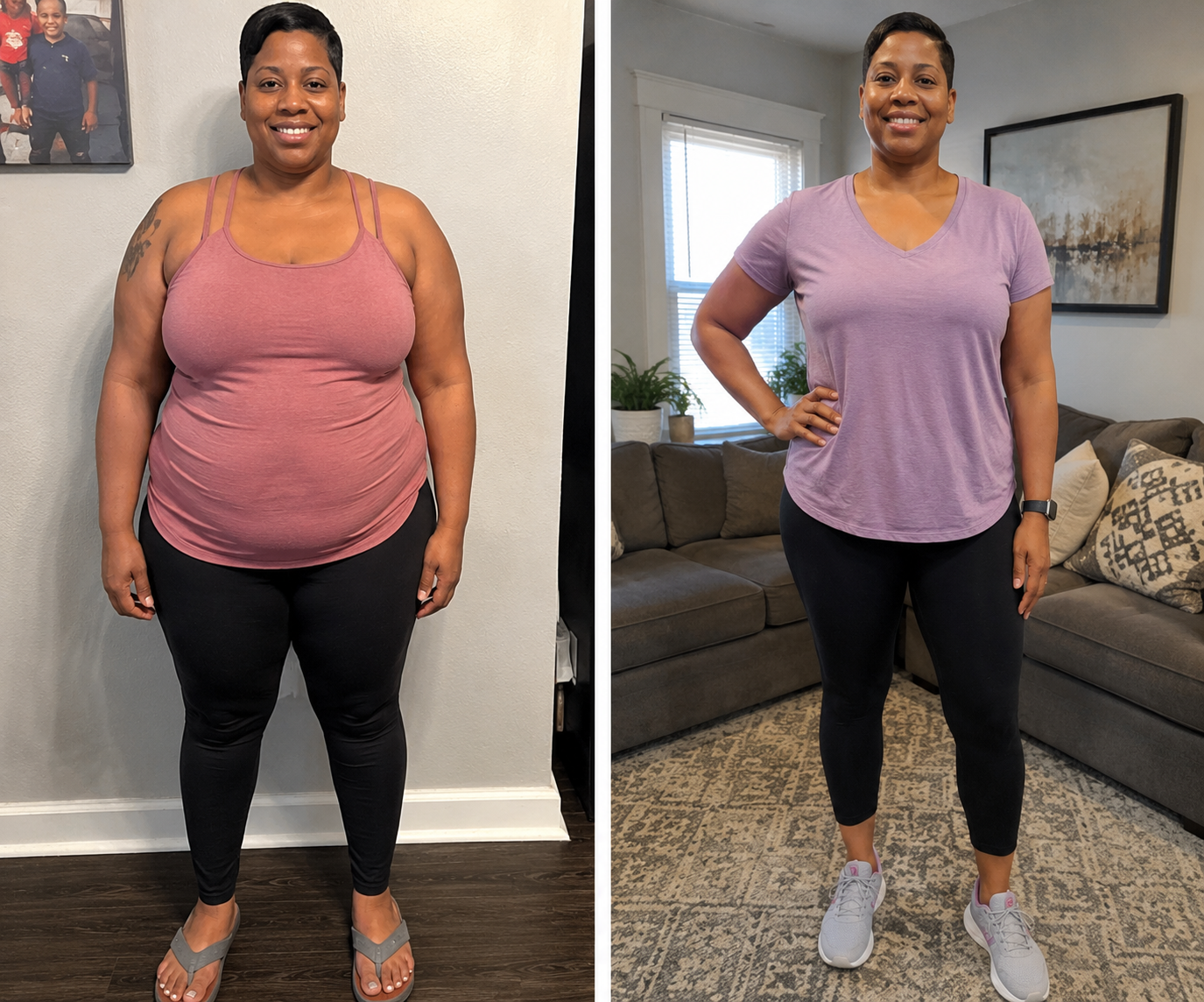 Real patient before and after weight loss photo result